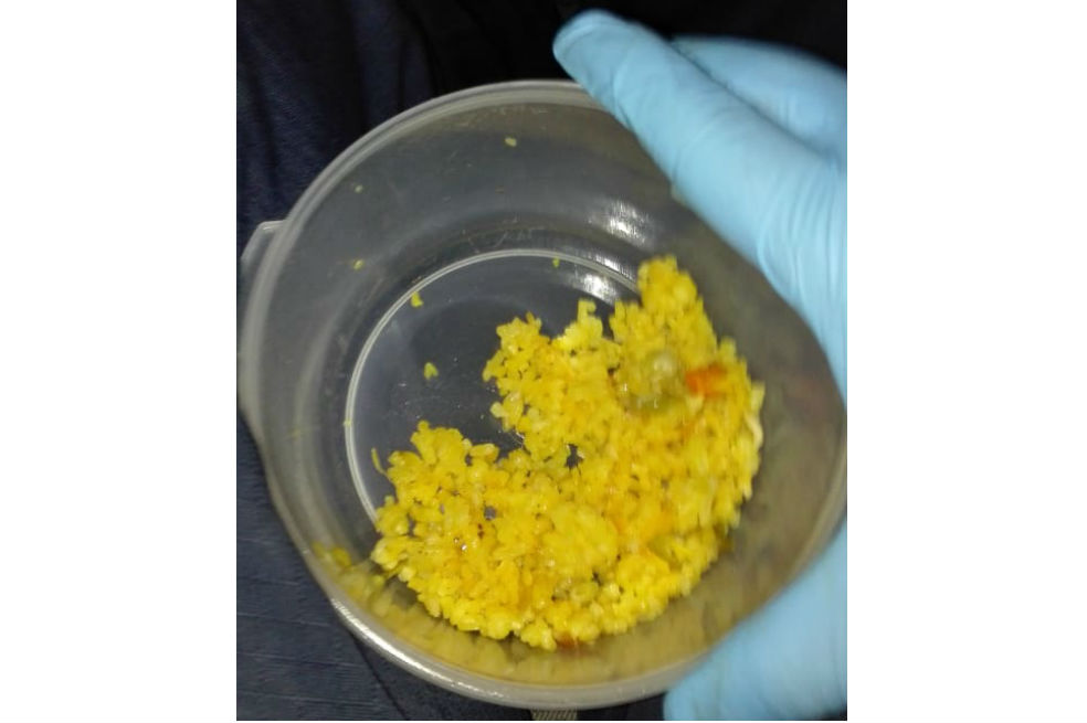 Intoxicación masiva en Soacha por arroz con pollo en mal estado