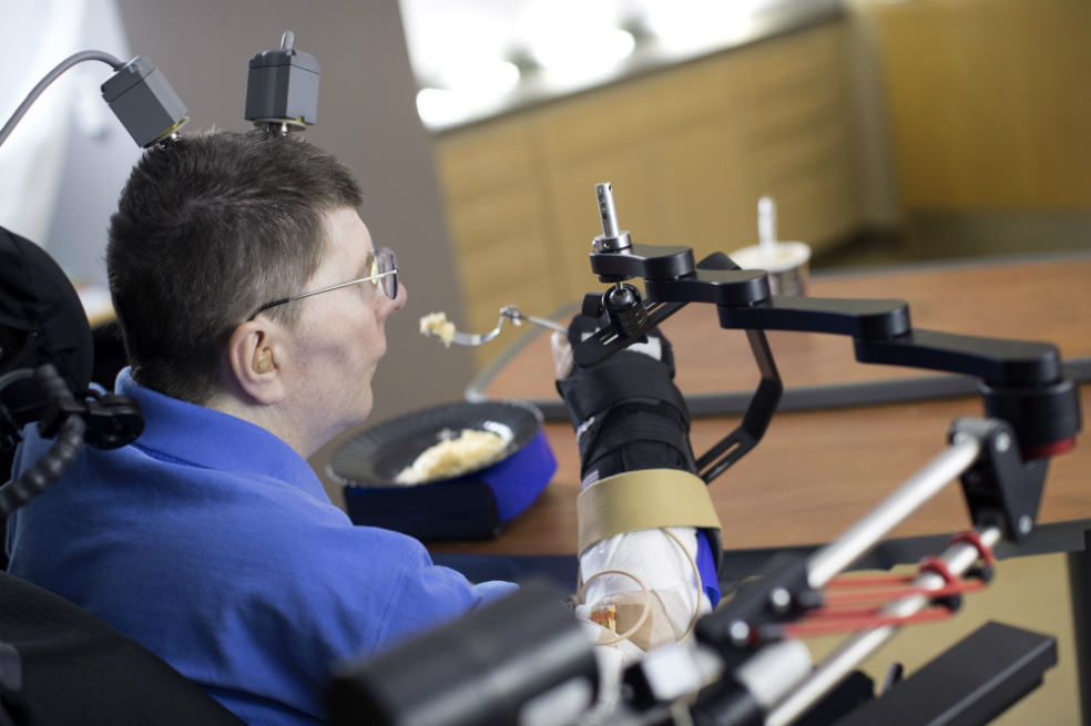 Hombre tetrapléjico recupera movilidad de su brazo gracias a la ciencia