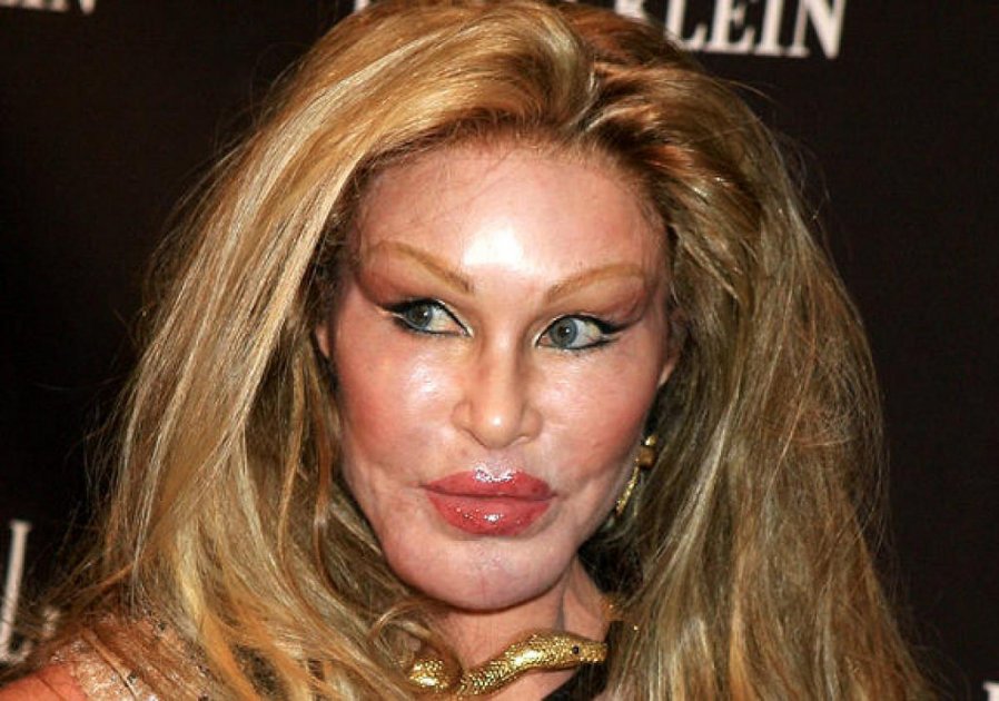 Jocelyn Wildenstein,se realizó varias cirugías para lograr una apariencia felina. / Celebrityabc - Flickr