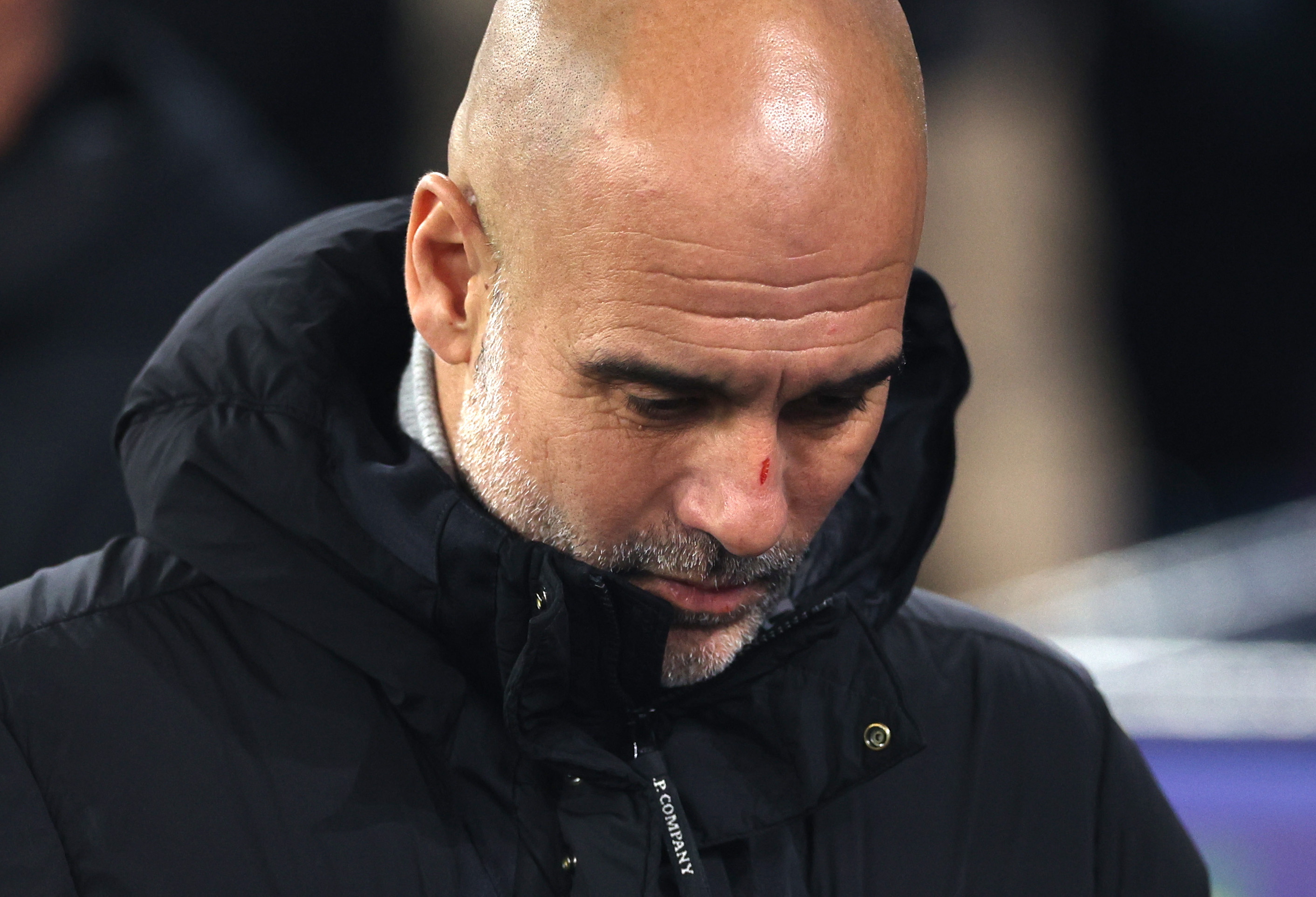 Pep Guardiola explicó por qué apareció con rasguños en conferencia de prensa