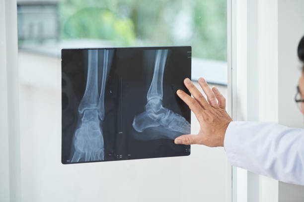 Cerca del 45% de los humanos no tendría este hueso, ¿cuál es?