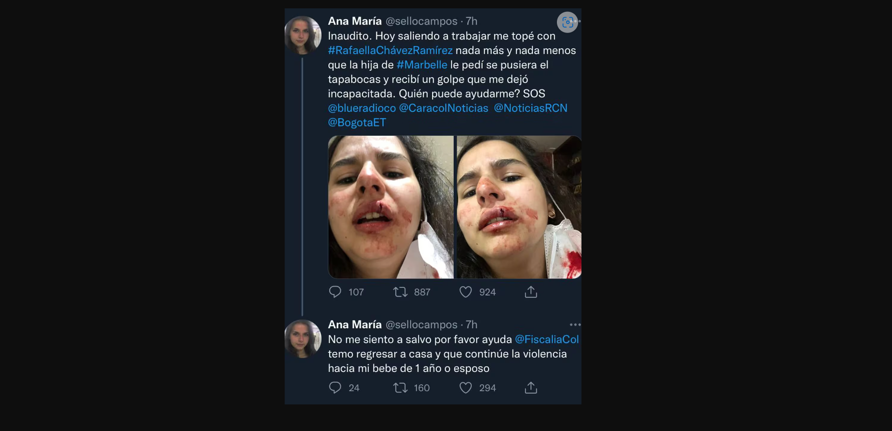 Hija de Marbelle habló de pelea que tuvo con su vecina: “Me arrastró del pelo”