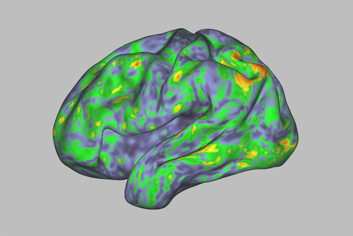 Así se ve el cerebro en un ‘viaje’ psicodélico