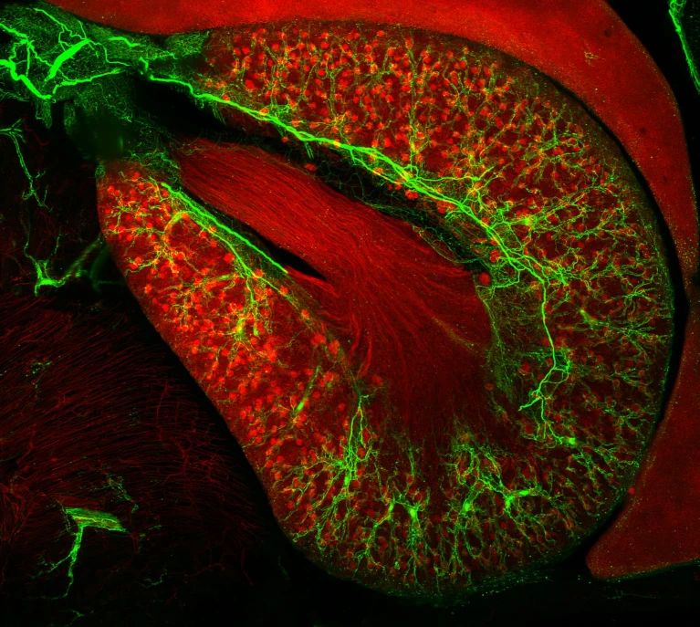 Se pueden observar los nervios simpáticos (en verde) ramificándose a través de la capa externa del riñón gracias al marcaje de anticuerpos de las proteínas en las células nerviosas. Crédito: M.-Y. Shi et al./Cell.