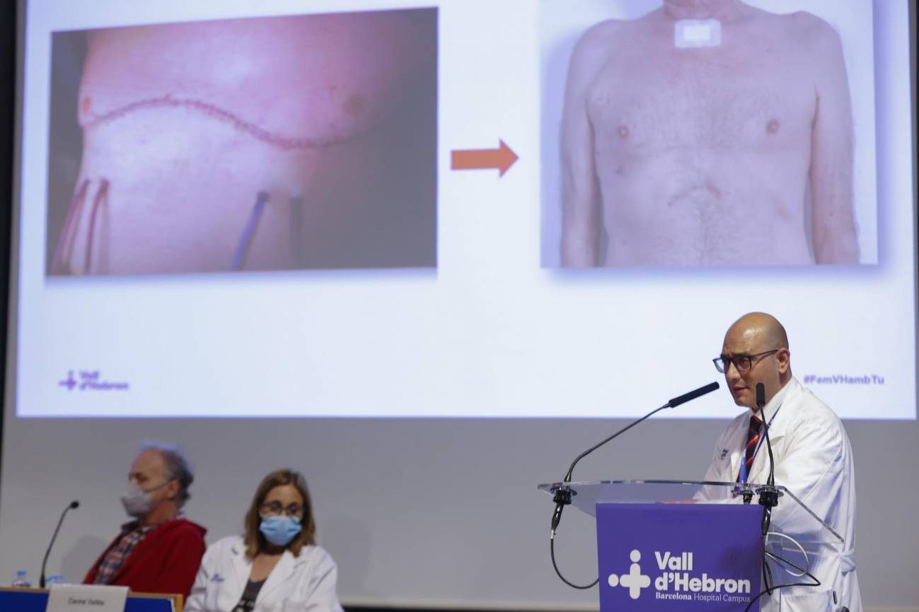 Realizan el primer trasplante de pulmón completamente robótico sin abrir el tórax