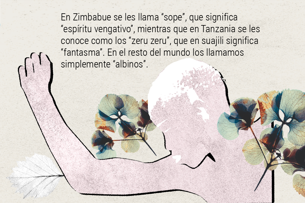 La “maldición” de ser albino en África: ¿por qué los quieren matar?