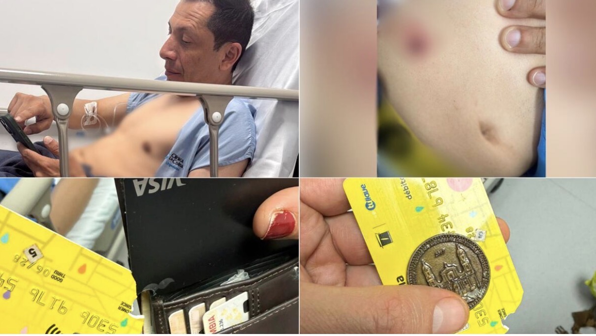 Funcionario de MinInterior fue herido al intentar evitar un robo en Bogotá, esto se sabe