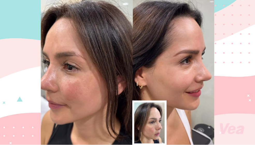 Carmen Villalobos mostró avances de la lucha contra enfermedad que afecta su piel