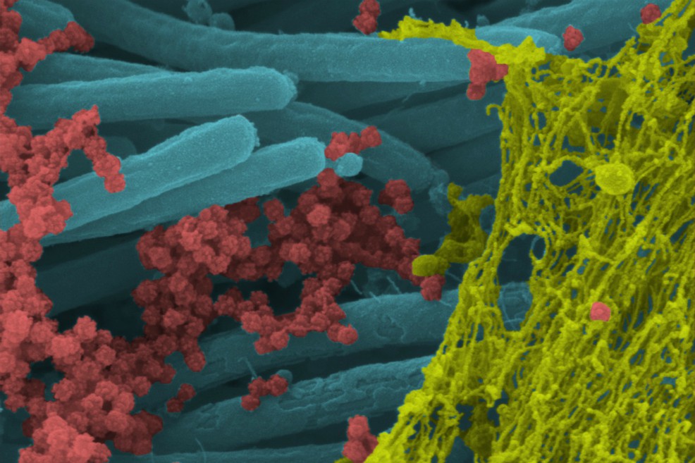 Logran una “foto” microscópica de una célula infectada por el coronavirus