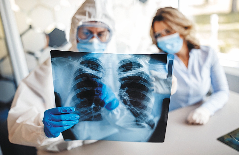 Las secuelas que deja el virus y el reto de recuperar la salud