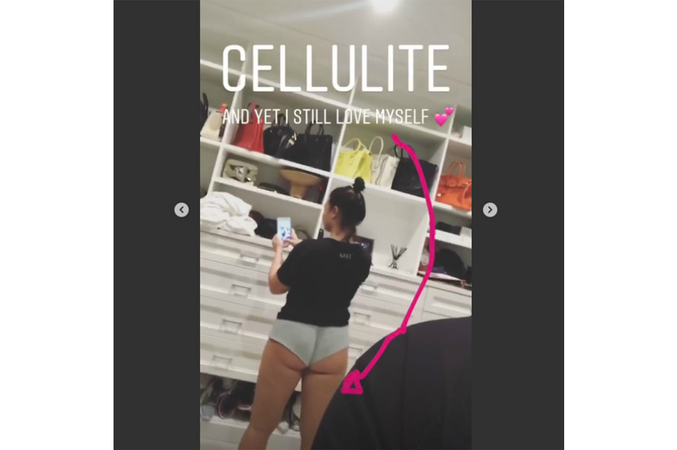 Demi Lovato se muestra al natural con sus estrías