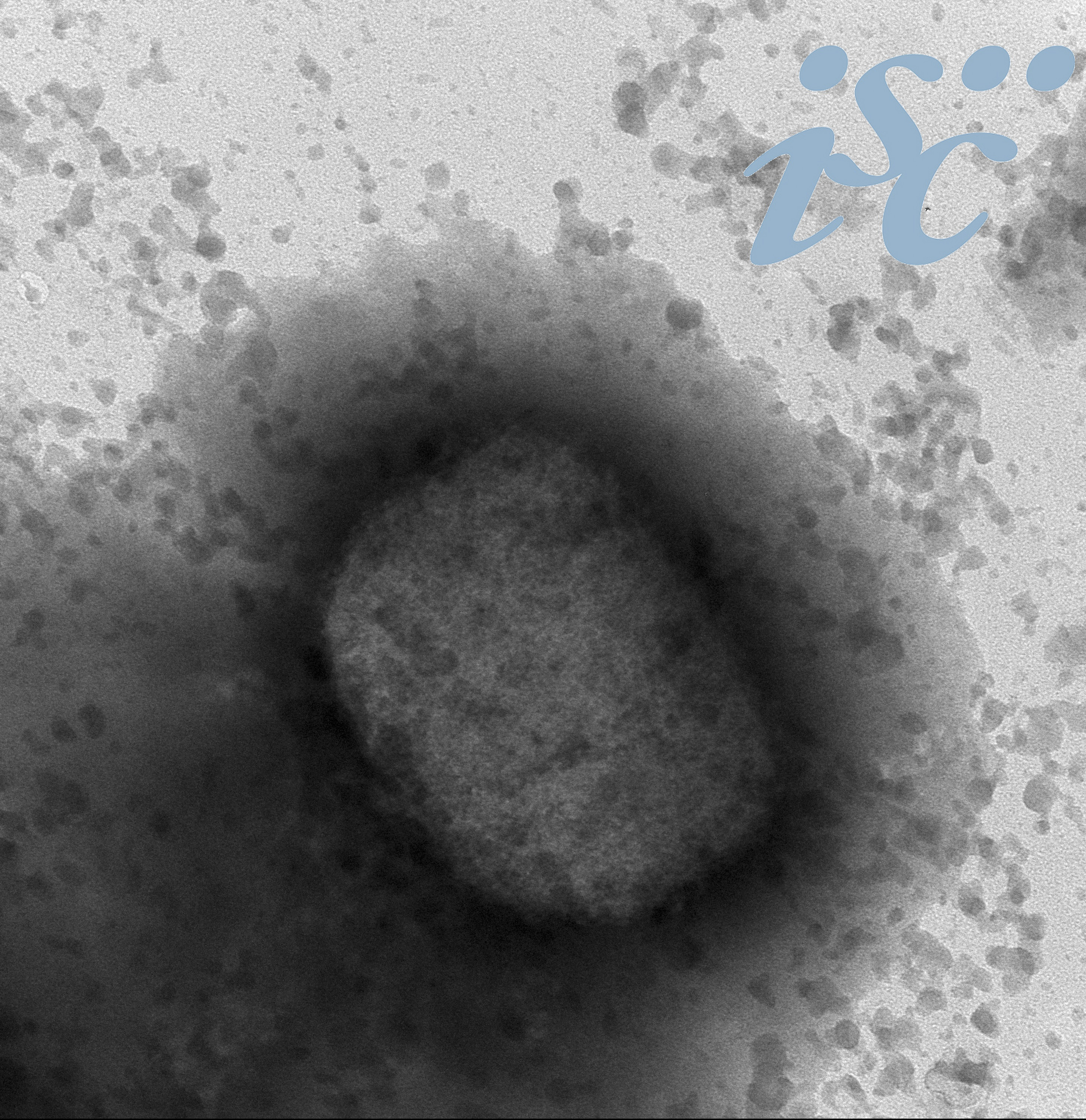 Argentina confirma los dos primeros casos de “viruela del mono” en América Latina