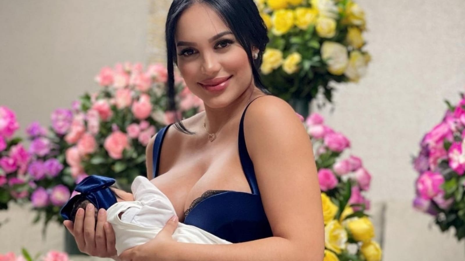 Andrea Valdiri preocupó al contar que su hija contrajo enfermedad por una mordida