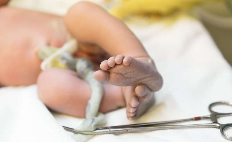 El cordón umbilical es una de las mejores fuentes de células madre hematopéyicas o sanguíneas. / Getty Images