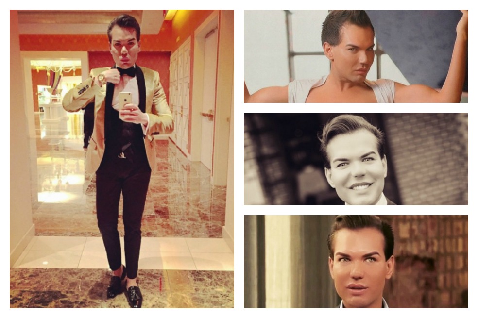Rodrigo Alves, el ‘Ken’ humano ¿un narcisista adicto a las cirugías?