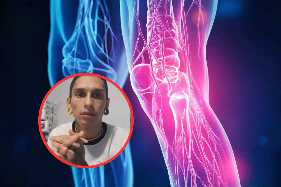 Osteomielitis: problema que atacó a joven bogotano que se aplicará la eutanasia