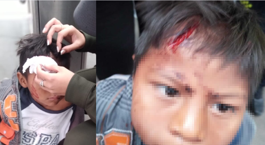 Policía perseguía a un sujeto y le lanzó el bolillo, pero le pegó a un niño embera