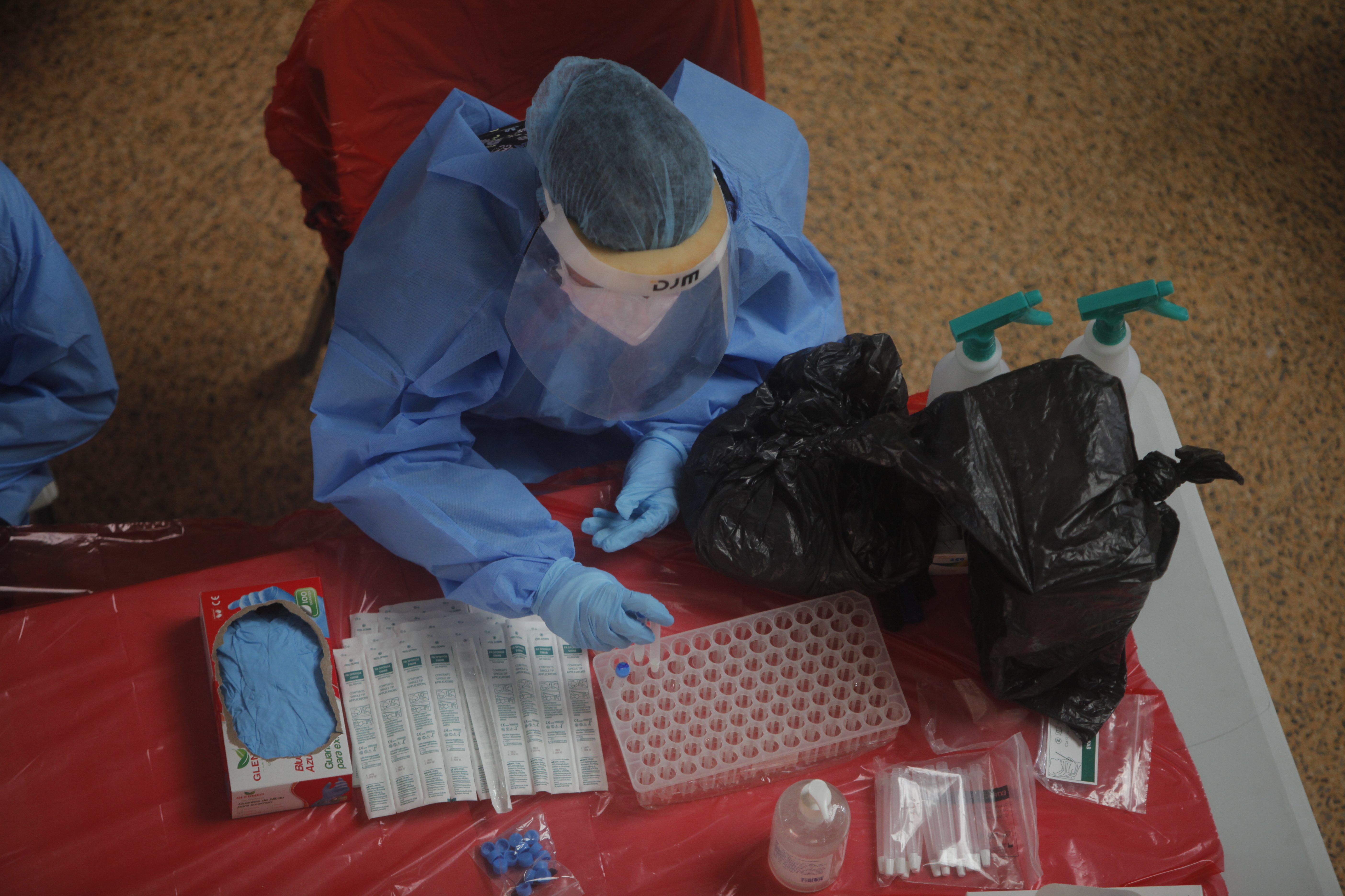 Así es como el coronavirus afecta el sentido del olfato