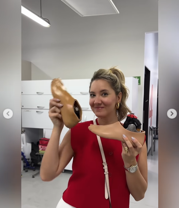Daniela Álvarez y su prótesis.