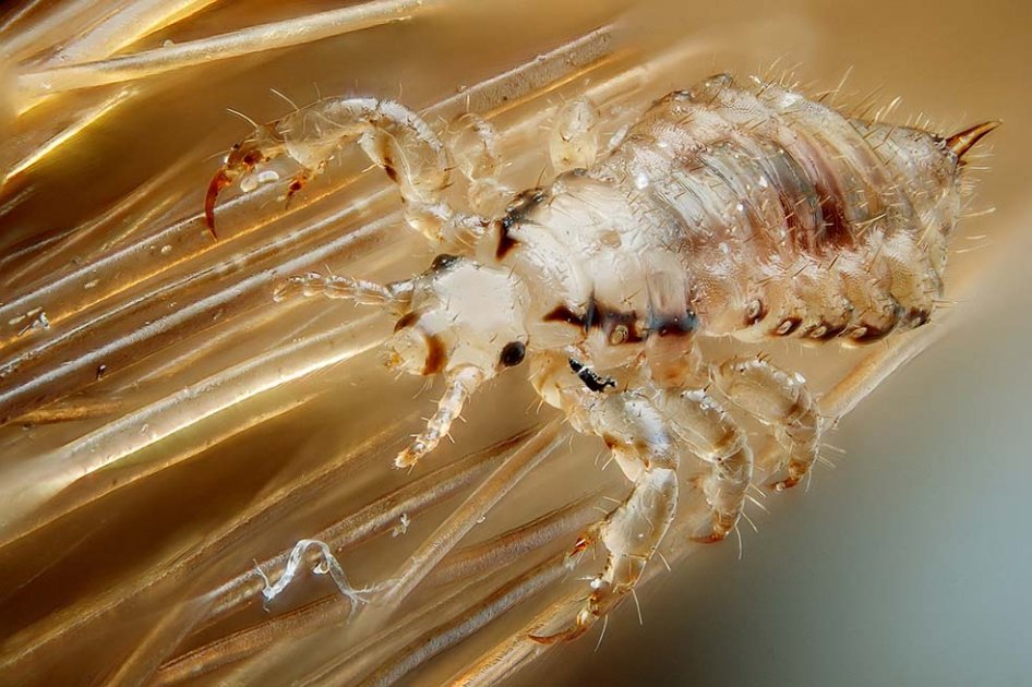 “Pediculus humanus capitis”.