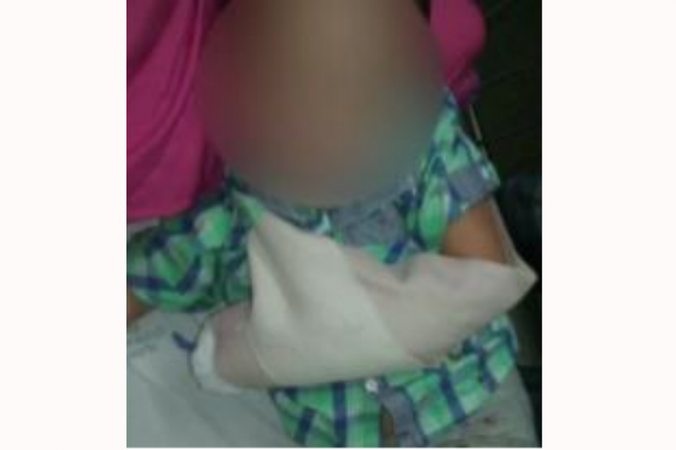 Niño herido al quedar atrapado en escaleras eléctricas de centro comercial en Barranquilla