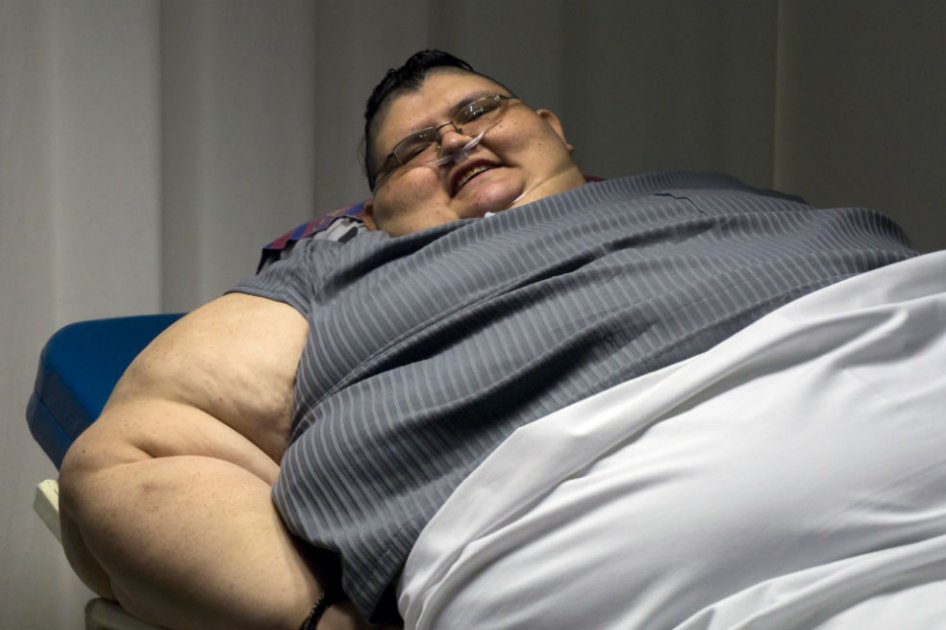 Uno de los hombres más obesos del mundo quiere reducir a la mitad sus 590 kilos