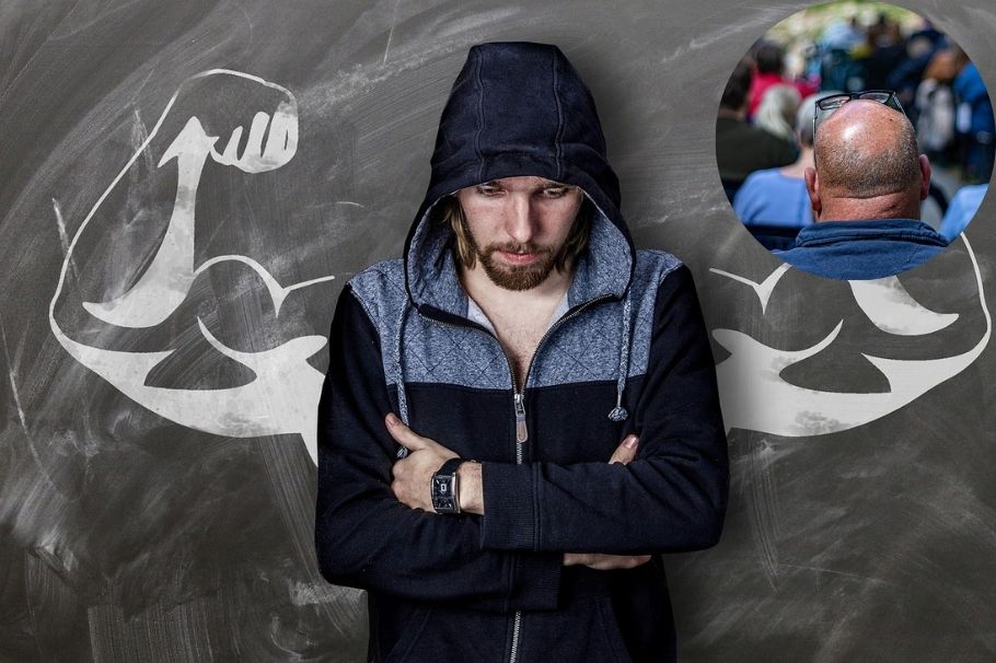 ¿La calvicie en algunos hombres es una lenta depresión? ¿Cómo aceptarla?