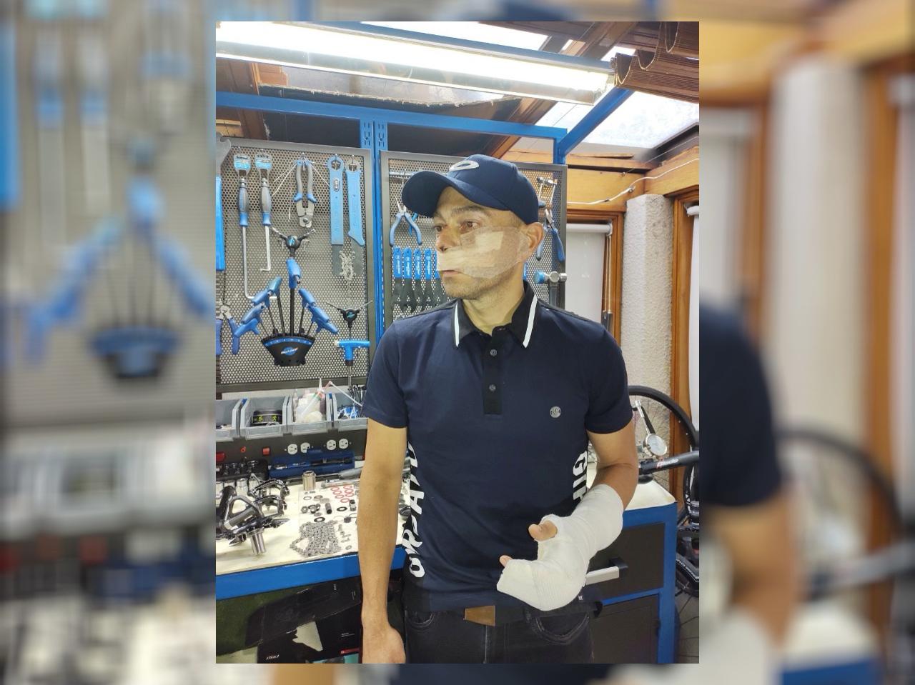 Por robarlo, delincuentes golpearon con un ladrillo a un ciclista en Bogotá