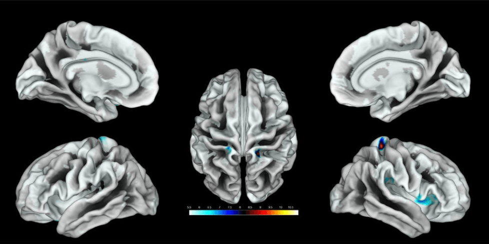 Así responde el cerebro femenino a la estimulación genital