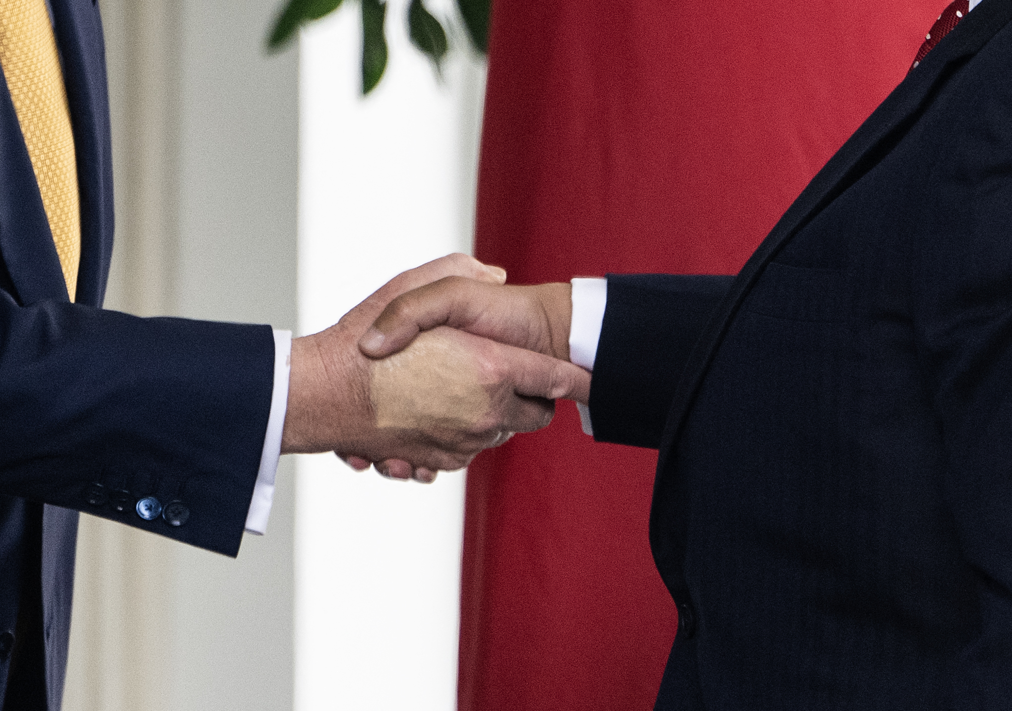 Insuficiencia venosa crónica: ¿qué es la enfermedad que le diagnosticaron a Trump?