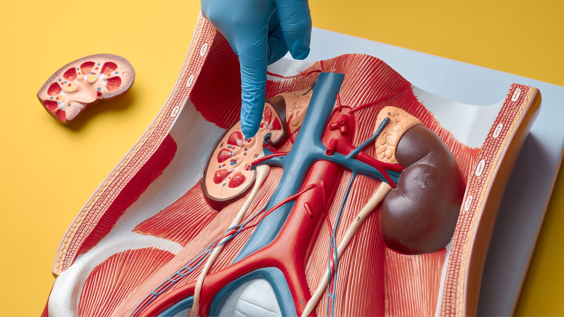 ¿Cómo cuidar a un familiar con falla renal avanzada?