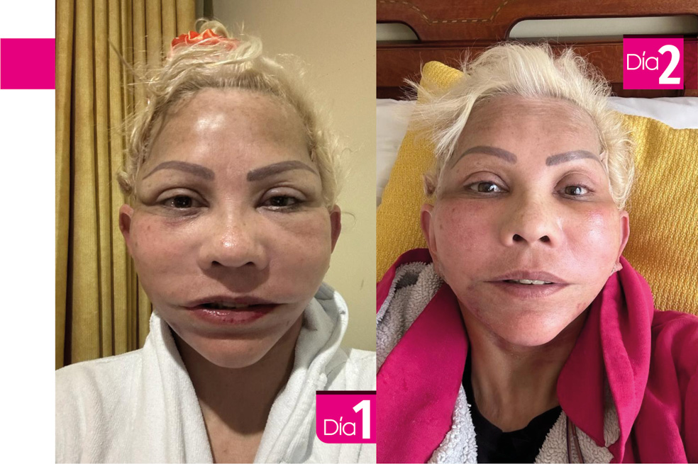 Así fue la transformación de la gorda Fabiola