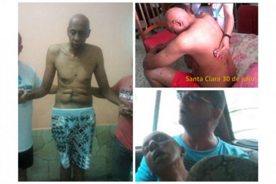 El cubano Guillermo Fariñas deja huelga de hambre y sed de casi dos meses