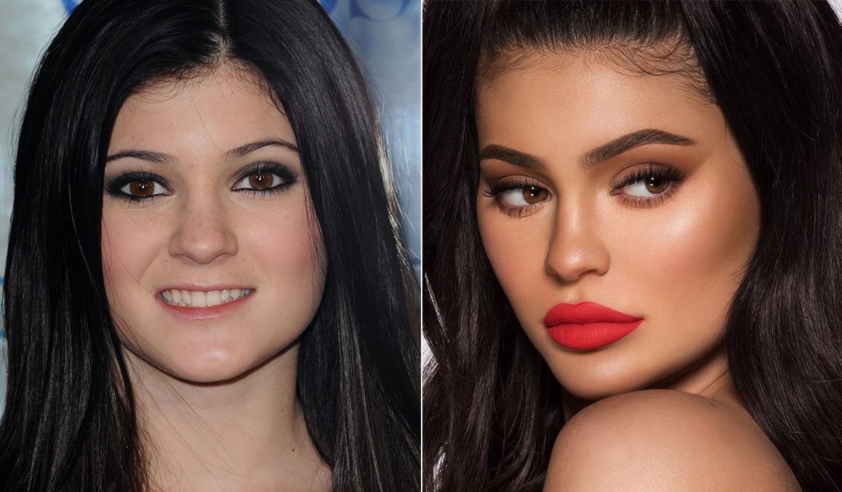 Kylie Jenner reveló qué cirugía se arrepiente de haberse practicado