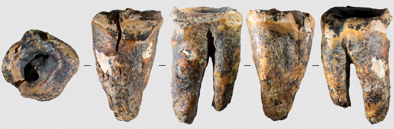 Molar Chagyrskaya 64 y sus macrocaracterísticas: vista general del diente en cinco proyecciones.. / Zubova et al., 2026, PLOS One