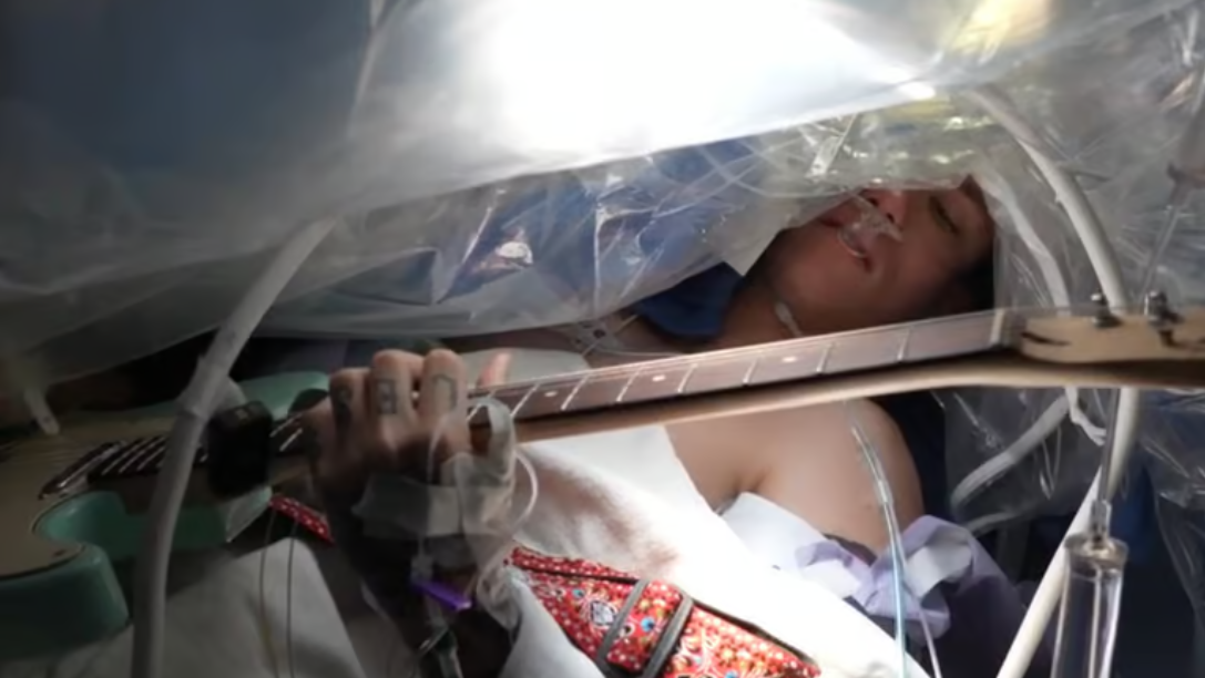Guitarrista tocó mientras le realizaban cirugía para extirparle tumor cerebral