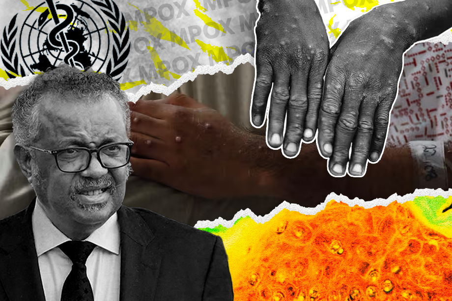 EE le explica: ¿Qué tanto avanza la mpox o viruela símica y qué podemos hacer?