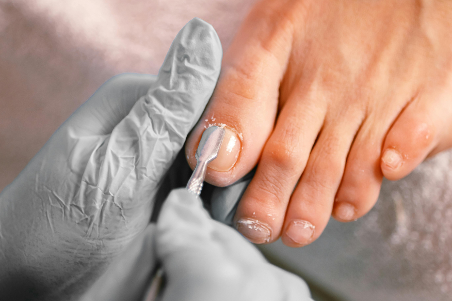 Uñas, pies