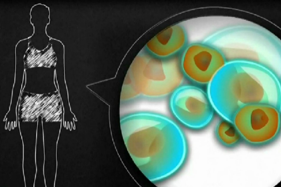 Rehabilitarse en casa puede resultar más efectivo para personas con esclerosis múltiple