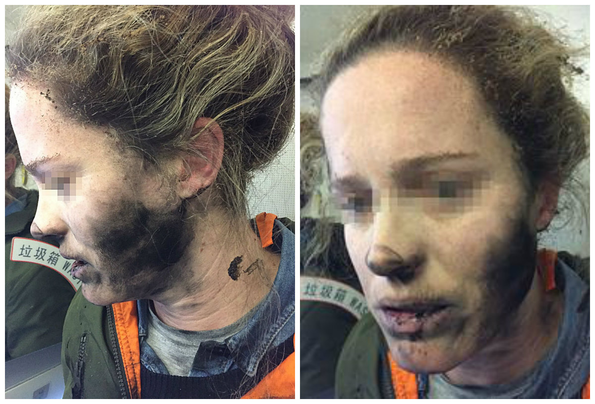Mujer en Australia sufrió quemaduras por explosión de sus auriculares en pleno vuelo