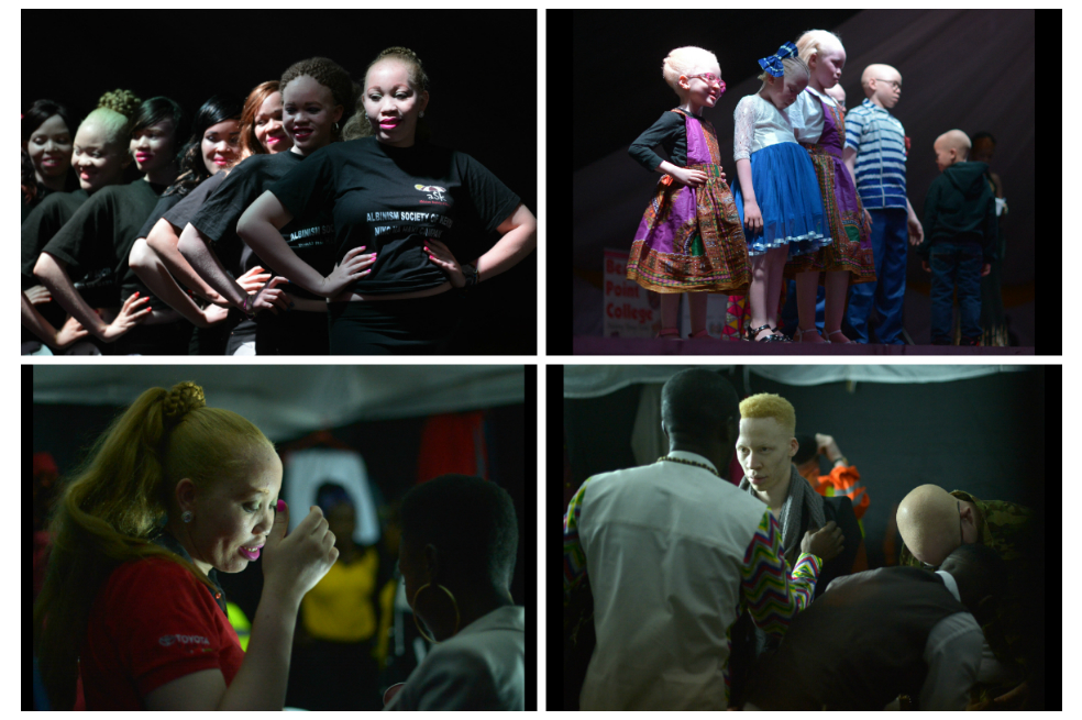 Un desfile de albinos para luchar contra los estereotipos sobre esta condición