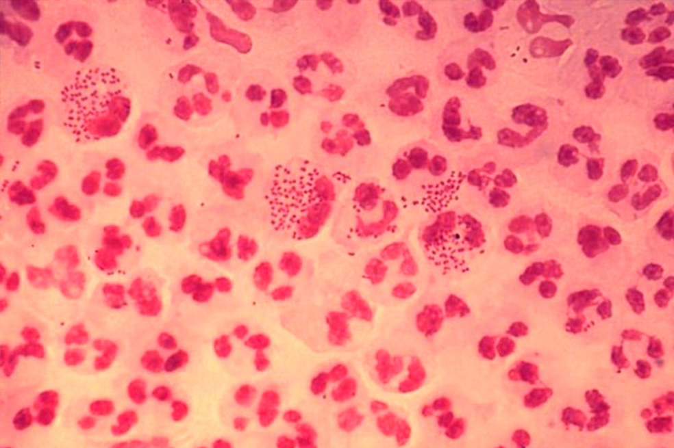 Imagen microscópica de la bacteria causante de la gonorrea. / Wikimedia - Creative Commons. 