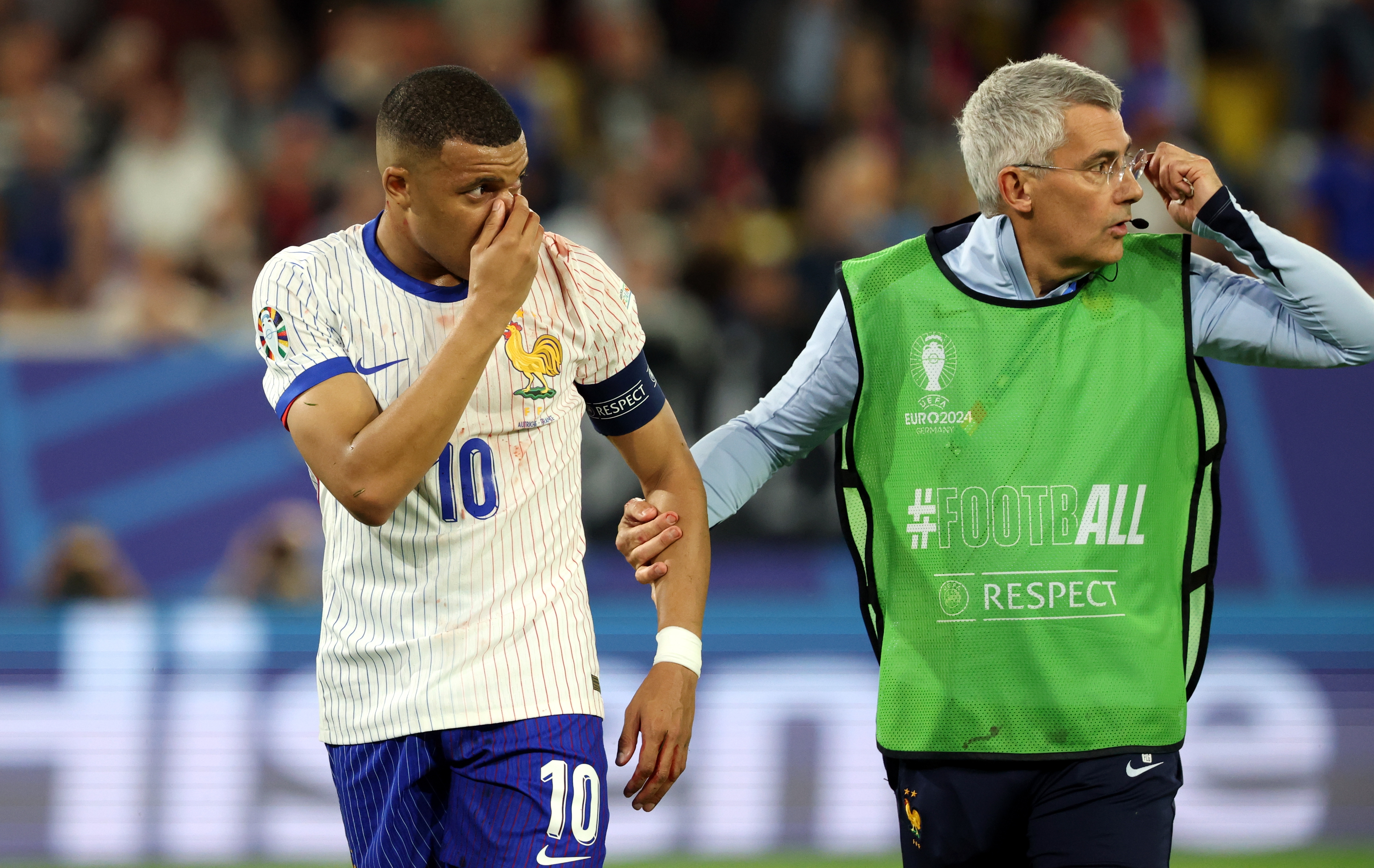 Las fracturas de nariz en el fútbol y el regreso de Mbappé enmascarado