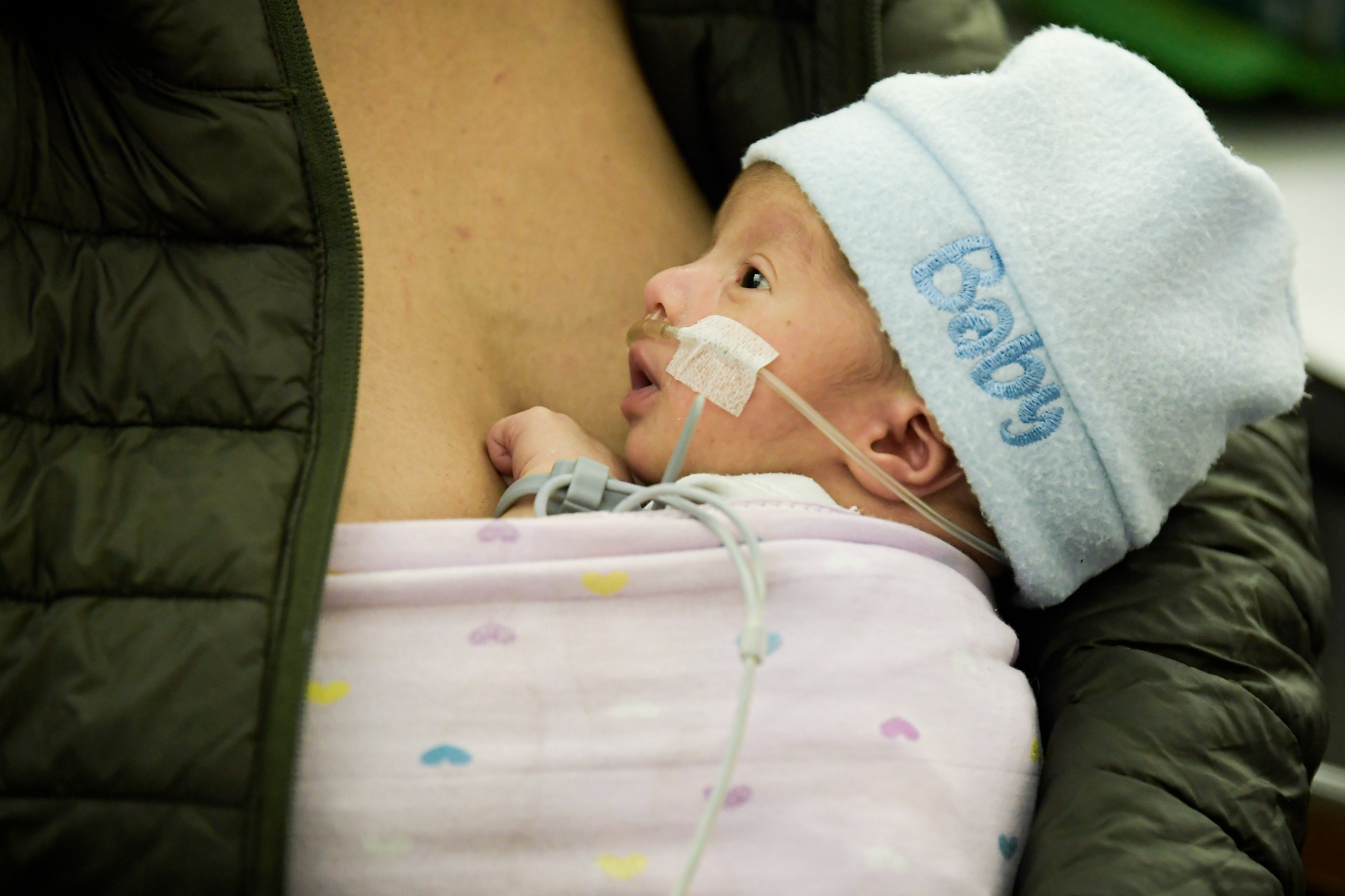 El programa Canguro ha salvado a miles de bebés prematuros desde 1978. Hoy tambalea