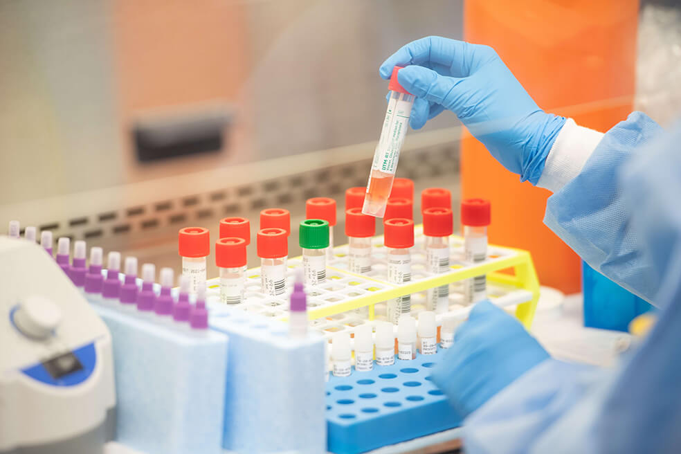 Seis departamentos ya tienen capacidad diagnóstica para Covid-19, según el INS