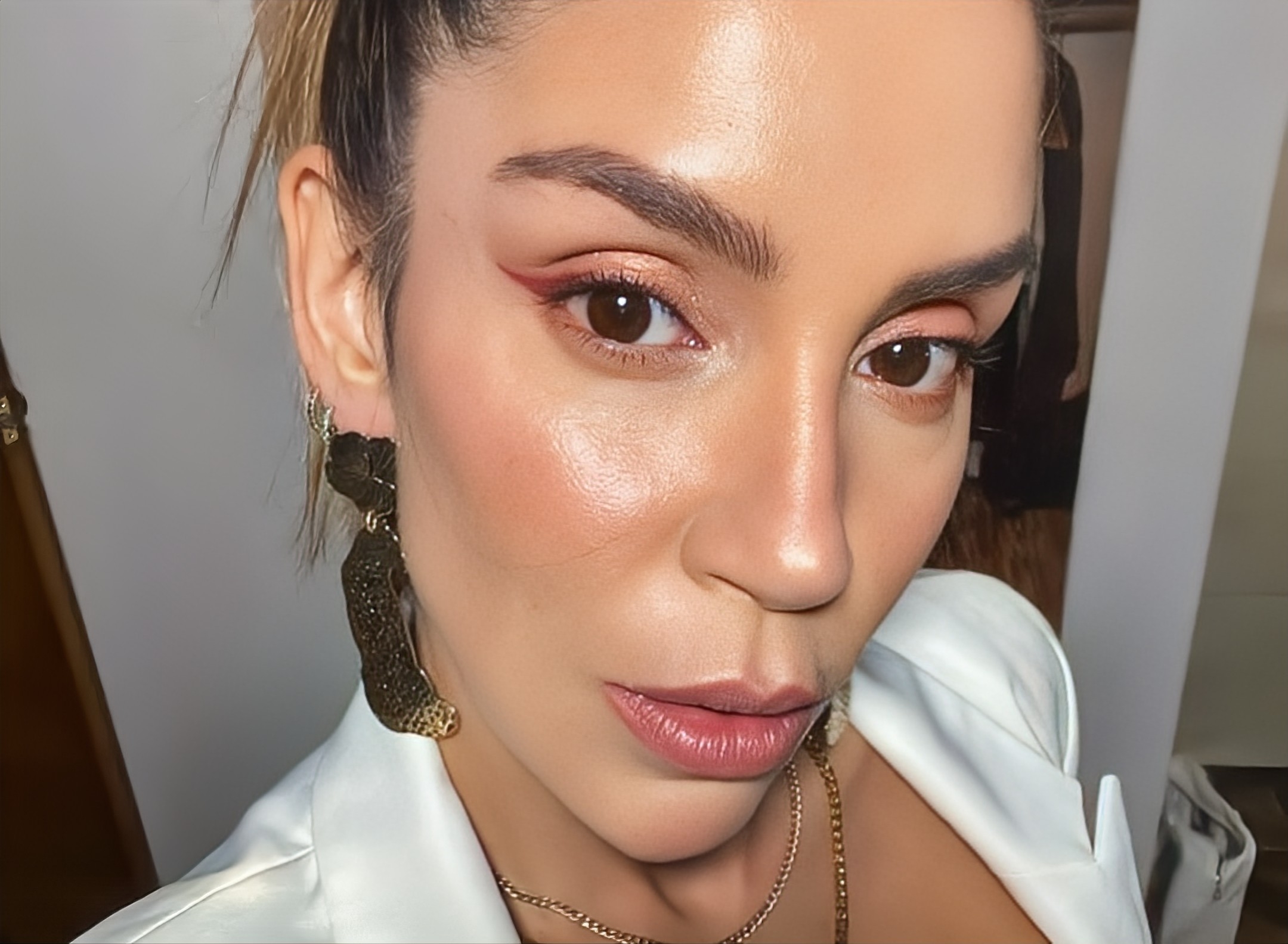 Valentina Lizcano se sometió a dolorosa cirugía: “De esta me voy a recuperar”