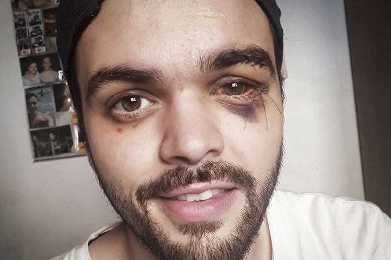 «No te calles, no seas cómplice»: carta del jugador de rugby golpeado por ser gay