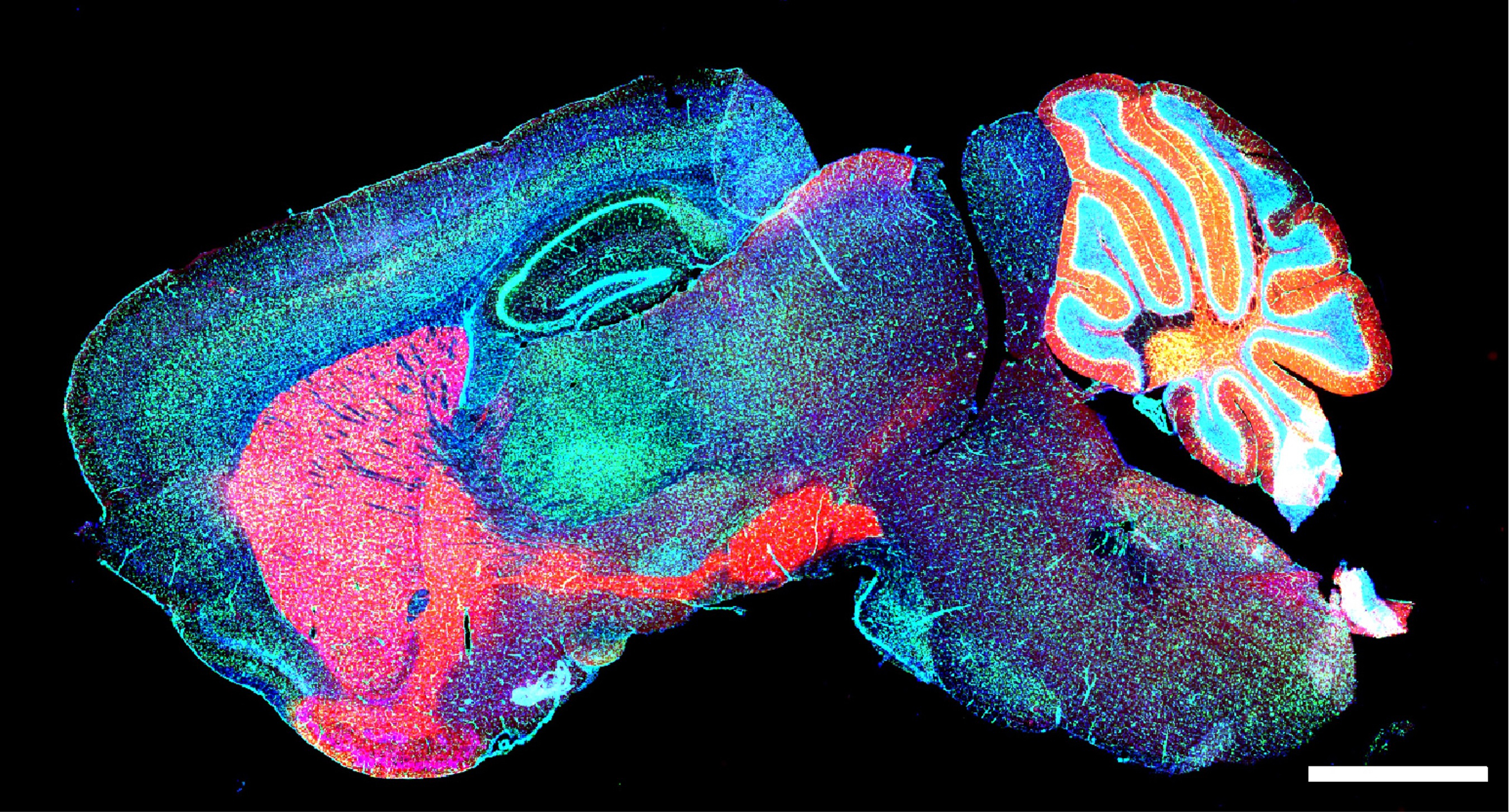 Neuronas GABA (ácido gamma-aminobutírico) del cerebro de un ratón. / Yayun Wang (China).