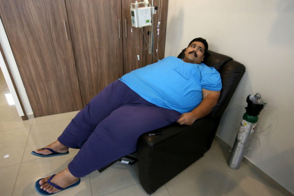 Andrés Moreno, hombre más obeso del mundo murió tras tomar bebidas energéticas