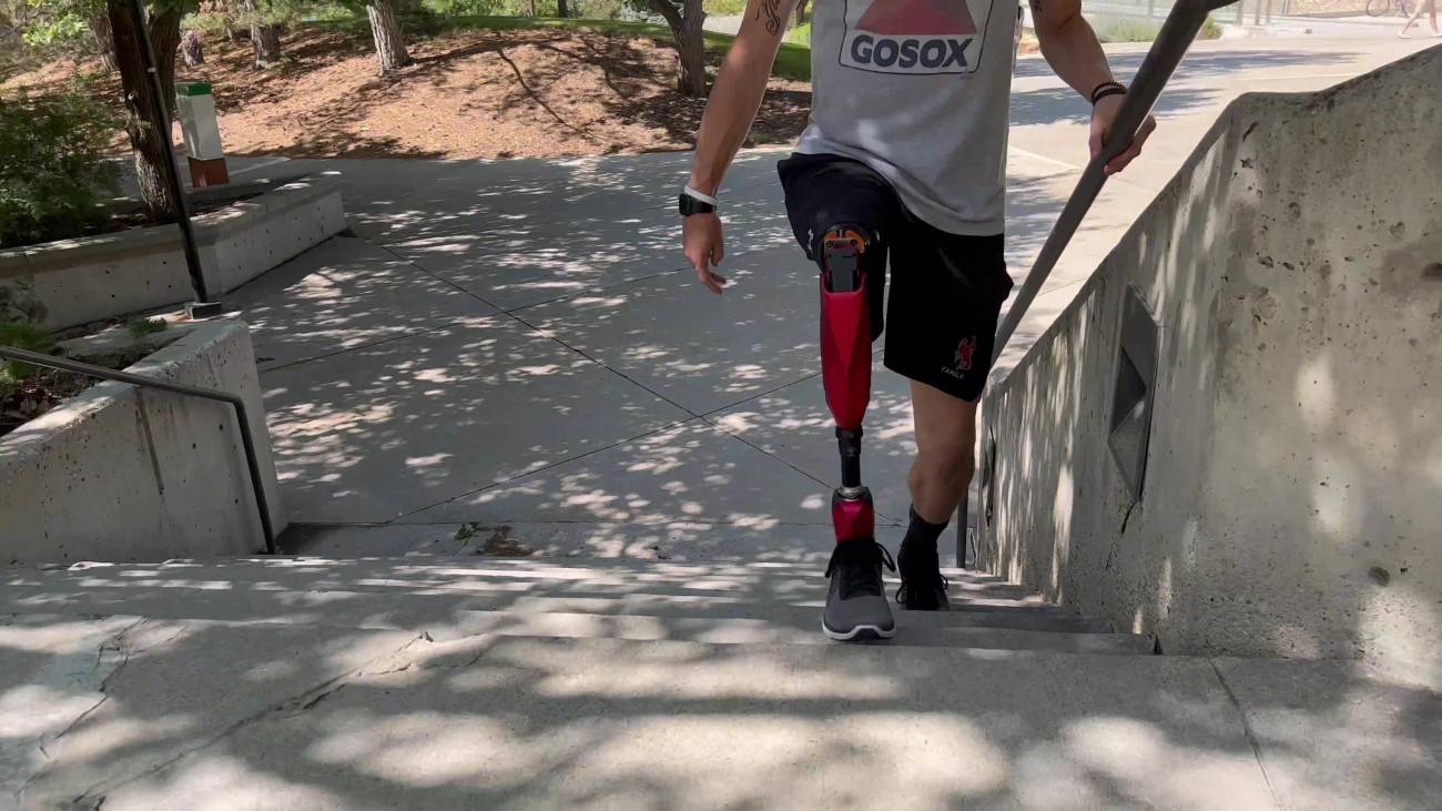 Nueva prótesis robótica permite subir escaleras y dar zancadas